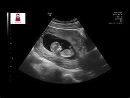 تعرف على اهم عوارض اعراض المس العاشق للمتزوج وتأثيره واسبابه وطرق العلاج الصحيحة ويعتبر الجن هم نوع من المخلوقات تختلف طبيعتهم عن طبيعة البشر كما ان عالم. Ø§Ù„Ø´Ù‡Ø± Ø§Ù„Ø®Ø§Ù…Ø³ Ù…Ù† Ø§Ù„Ø­Ù…Ù„ ÙˆØ§Ù„Ø¬Ù…Ø§Ø¹ Ø¹Ø§Ù„Ù… Ø­ÙˆØ§Ø¡ Ø§Ø¹Ø±Ø§Ø¶ Ø§Ù„Ø§Ø³Ø¨ÙˆØ¹ Ø§Ù„Ø®Ø§Ù…Ø³ Ù…Ù† Ø§Ù„Ø­Ù…Ù„ Ø¹Ø§Ù„Ù… Ø­ÙˆØ§Ø¡ Ø§Ù„Ø§Ø¹Ù„Ø§Ù†Ø§Øª Ø§Ù„ØªØ¬Ø§Ø±ÙŠØ© Ø§Ø¹Ù„Ø§Ù† ØªØ¬Ø§Ø±ÙŠ Ù„Ù„ØµÙ Ø§Ù„Ø®Ø§Ù…Ø³ Kayu Mania