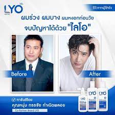 Jun 05, 2021 · โหนกระแสมาครบ 4 ปี หนุ่ม กรรชัย ขอบคุณทุกภาคส่วน ทั้งสรยุทธที่สอนตั้งแต่เทปแรก ไปจนถึงคู่แข่งทางธุรกิจ วันนี้ (5 มิถุนายน) เป็นวันที่ครบรอบ 4 ปี. Lyo à¹à¸®à¸£ à¹‚à¸—à¸™ à¸„ à¸«à¸™ à¸¡à¸à¸£à¸£à¸Š à¸¢ à¸œà¸¡à¸£ à¸§à¸‡ à¸œà¸¡à¸«à¸‡à¸­à¸ Shopee Thailand