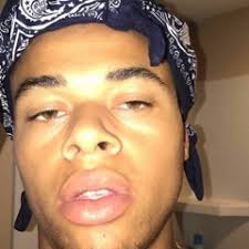 Stream Icemonsters music