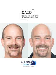 Dr Maria Araque explains the options that we provide to get your teeth  white and sparkling. We offer both in-chair and take-home professional  whitening treatments — so whether you want instant results