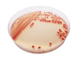 Image result for Striga baumannii