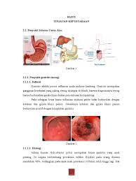 Penyakit gastritis adalah suatu serangan penyakit yang terjadi di organ lambung karena adanya peradangan pada dinding lambung. Peran Kunyit Dalam Penyakit Saluran Cerna Atas