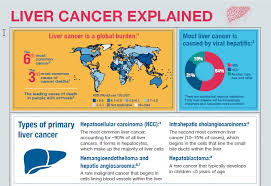 Liver cancer, also known as hepatic cancer, starts in the liver. Easlnews On Twitter To Mark Worldcancerday 4 Feb Easl Is Launching A User Friendly Infographic Livercancer Explained Https T Co Kbbgvsbfgo Learn About The Global Burden Of Liver Cancer Causes Types Risk Factors Prevention