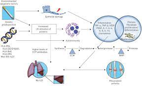 Rheumatoid Arthritis Associated Lung Disease European Respiratory Society