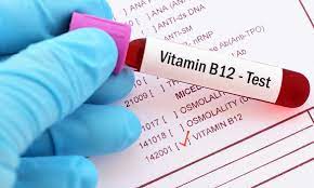 As you can tell, vitamin b12 affects the whole body, and therefore obviously would have disastrous effects on hair growth as well. Vitamin B12 Deficiency Can Lead To Hair Loss Hair Club
