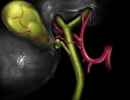 Care sunt simptomele pietrelor la colecist? Fierea LenesÄƒ NesimÅ£itÄƒ Ca O Pensie Blogul Otiliei