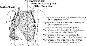 ekg