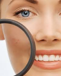 Image result for xantelasma