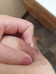Pierced Nipples: What Are The Health Risks?