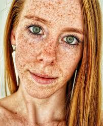 Did someone say Freckles? 👩🏻‍🦰 What eye color do you have?💙🤎💚freckles