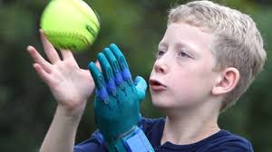 Boy now has 6 'left hands'