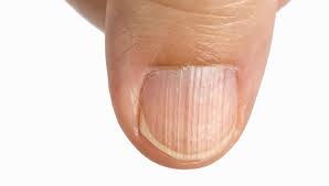While severe zinc deficiency can cause a variety of extreme symptoms, researchers estimate that a large. Signs Of Zinc Deficiency 2 Peace With Endo