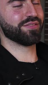 Render Bars vs Concrete Lintels