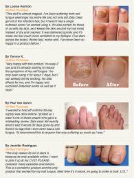 toenails fungus