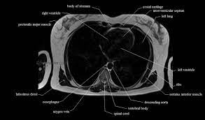 There are around 650 skeletal muscles within the typical human body. Chest Anatomy Mri Chest Thorax Axial Anatomy Free Cross Sectional Anatomy