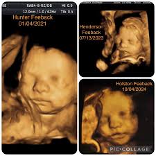 Miracles Happen 3D/4D/HD Ultrasound