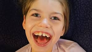 Vancouver's Crab Park brings its encampment protest to Victoria