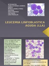 El término aguda significa que la leucemia puede progresar rápidamente y, si no se trata, probablemente sea. Leucemia Linfoblastica Aguda Lla Pdf Leucemia Linfocitos