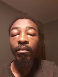 Is this plant poison ivy in Pennsylvania?