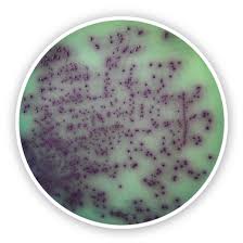 What diseases are caused by pseudomonas aeruginosa? Pseudomonas Chromogenic Agar Chromogenic Media Anhydrous Nutrient Media For Microbiology Microbiology Life Science Carl Roth International