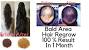 Fenugreek Hair Growth Before And After