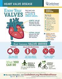 Pathology, complications, diagnosis and treatment. Mitral Regurgitation Cardiosmart American College Of Cardiology