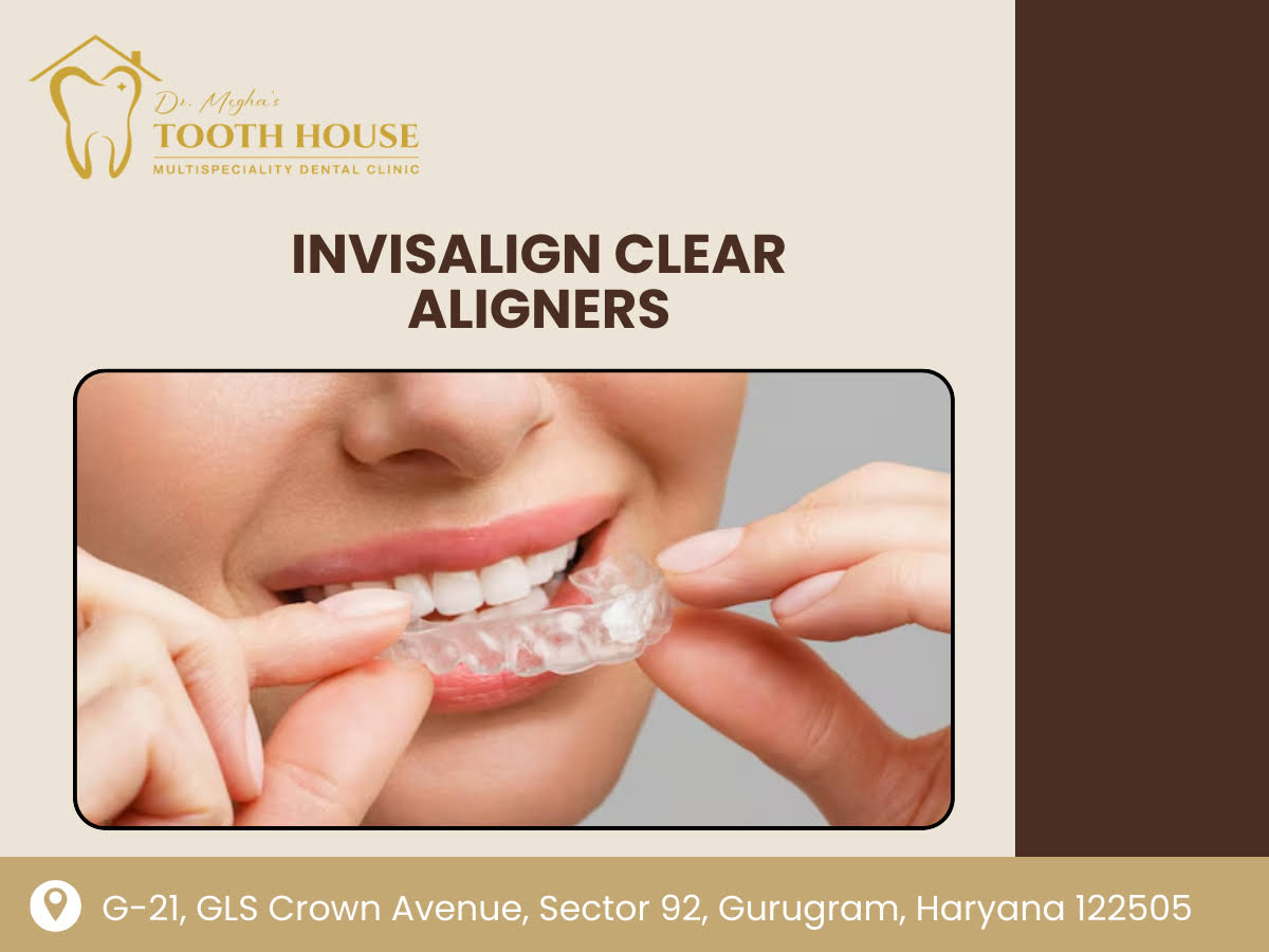 Invisalign Clear Aligners product image