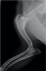 Sneezing, difficulties in breathing, nose bleeds or other nasal discharges are common symptoms of bone cancer in dogs when the cancer has occurred in or around the nasal cavity. The Pet Oncologist Vet Oncologist Online Online Vet Education Bone Cancer In Dogs