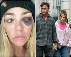 Denise's career recovery after a public scandal