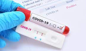 If you think a negative test result means you don't have coronavirus, you could be wrong. Pro Cesty Do Usa Bude Od 26 Ledna Nutny Negativni Test Na Covid 19 Velvyslanectvi Usa V Ceske Republice