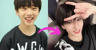 Talent agency sm entertainment recently announced that due to a knee injury, nct member jisung will not be taking part in performances for . Watch Nct S Jisung Grow Up His Broadcast History From Pre Debut To Nct 2020 Koreaboo