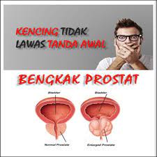 Kencing tak lawas atau urinary incontinence merupakan situasi tanda penyakit yang dihadapi oleh kaum lelaki. Pros40 Kencing Tak Lawas Kerap Kencing Kencing Tidak Lawas Prostat 1 Botol Shopee Malaysia