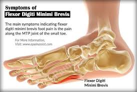 Pin On Joint Pain