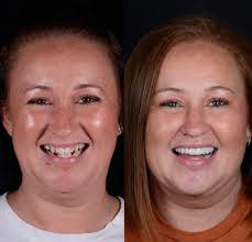 Sara Chen, DMD, MS (@dr.sarachen) • Instagram photos and videos