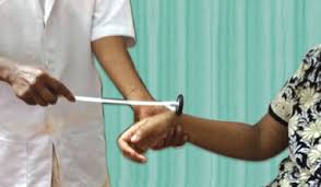 Image result for Supinator Reflex