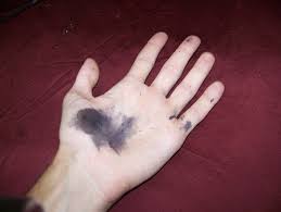 Image result for Silver Nitrate