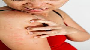 This is used to treat melanoma. Is Itchy Skin Ever A Sign Of Skin Cancer Howcast