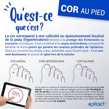 Podologue, dermatologue ou esthéticienne, qui consulter en cas de cors aux pieds très douloureux ou les causes des cors au pied d'une manière générale, le cor au pied résulte d'un frottement entre l'orteil et la chaussure. Cor Au Pied Douloureux Que Faire Epitact