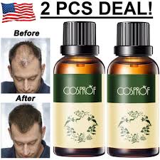 Pura d'or hair loss prevention shampoo and conditioner. 2 Pack Hair Growth Products For Men Women Natural Oil Serum Loss Grow Fast Treatment Walmart Com Walmart Com