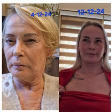 Has anyone used Musely's Neck Cream? If so, what were your results?  Debating