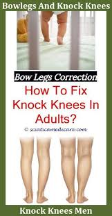 Bow Legged Baby What Does Bow Tattoos On Back Of Legs Mean Bow Leg Surgery Recovery Time Bow Legged Man Is Bow Leg Knock Knees Bow Legged Bow Legged Correction