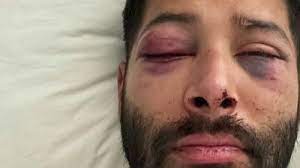 Crimen De Odio Hombre Es Golpeado Afuera De Bar Lgbtq En El Centro De El Paso Telemundo El Paso 48