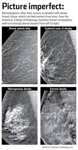 Pin On Radiology 2