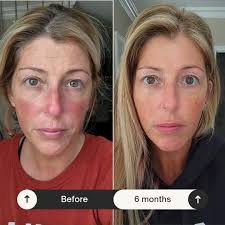 ⭐️ Oliveda Product Spotlight ⭐️ ➡️ 𝗧𝗵𝗲 𝗙𝟳𝟲 𝗛𝗼𝗻𝗲𝘆 𝗘𝗻𝘇𝘆𝗺𝗲  𝗠𝗮𝘀𝗸 is an enzymatic mask that leaves us with a radiant and even  complexion! BONUS! The honey is also sourced from the