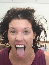 Denise accidentally stuck her finger in a light socket! Just kidding, she  had her first EEG done today to check her brain waves using electrodes and  this is what she looked like