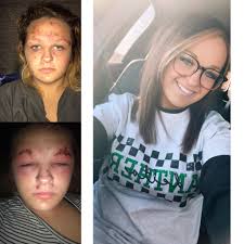 In 4 days I have 3 years… AGAIN! So grateful to be able to say that!! I was  given another chance 🩷 let's see transformations