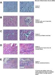 We did not find results for: Animal Models In Idiopathic Inflammatory Myopathies How To Overcome A Translational Roadblock Sciencedirect