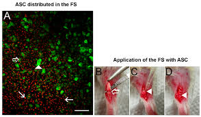 While yields have repriced upward since the beginning of the year, the pricing on the group's loans and advances remained low in q1 2021. Cells Free Full Text Transected Tendon Treated With A New Fibrin Sealant Alone Or Associated With Adipose Derived Stem Cells Html