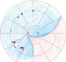 Ophthalmologists occasionally perform cryotherapy if the location of the tear makes it difficult to perform laser photocoagulation. Schematic Diagram Of The Retinal Detachment In The Left Eye Showing The Download Scientific Diagram