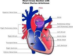 An error occurs as the fetal. Grown Up Congenital Heart Disease Guch Textbook Of Cardiology